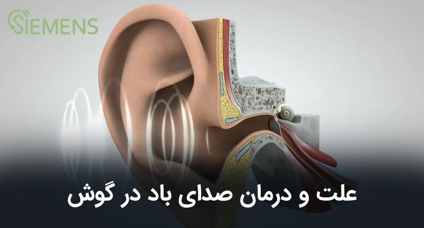 علت صدای باد در گوش