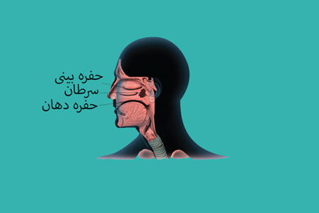 nasopharyngeal-cancer علائم سرطان نازوفارنکس