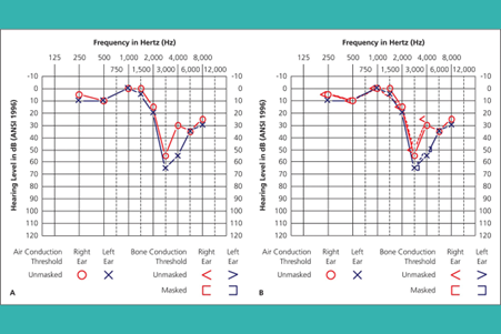 pte-result تفسیر نتایج تست pta