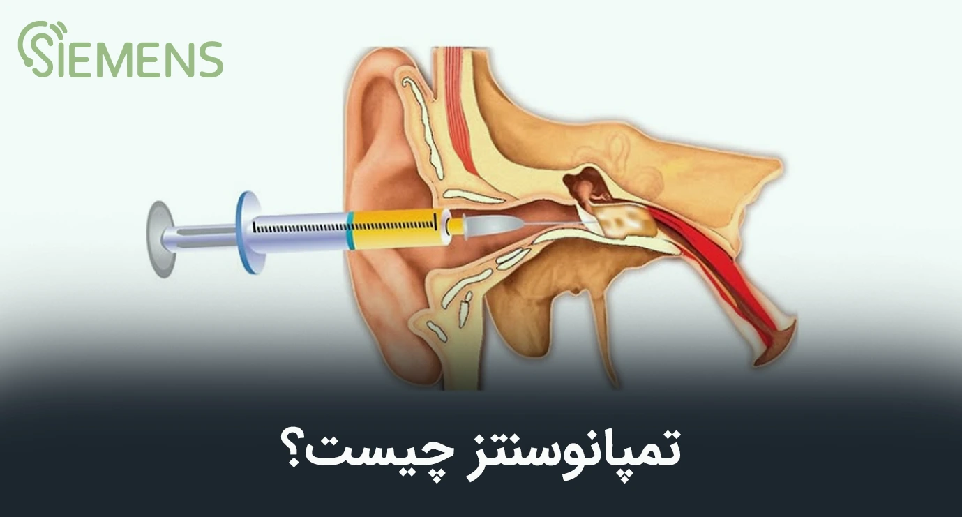تمپانوسنتز چیست