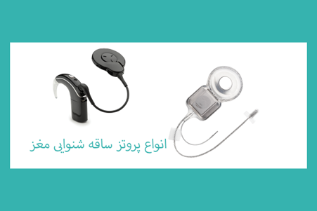 brainstem implant kinds انواع کاشت ساقه مغزی