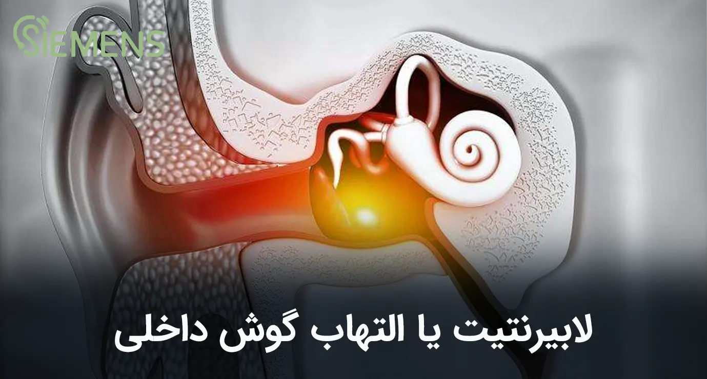 لابیرنتیت گوش