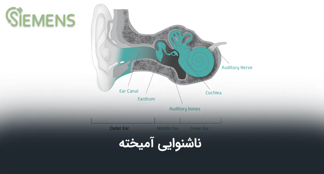 تصویر ناشنوایی آمیخته