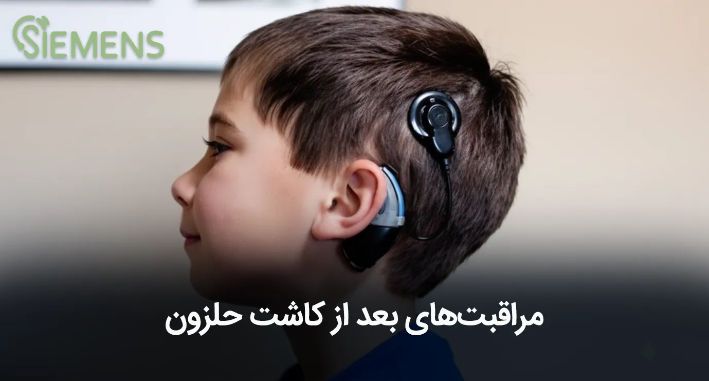 مراقبت های بعد از کاشت حلزون