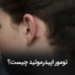 تومور اپیدرموئید چیست؟