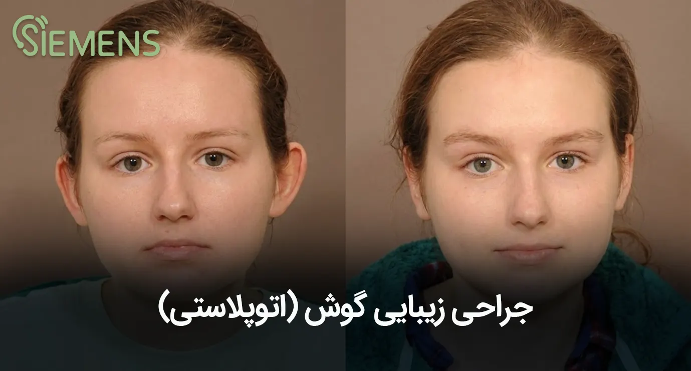 جراحی زیبایی گوش(اتوپلاستی)