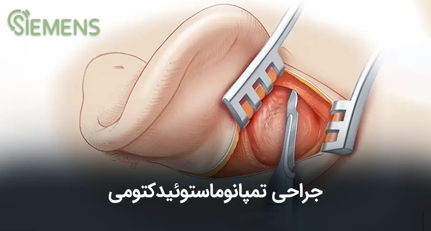 جراحی تمپانوماستوئیدکتومی