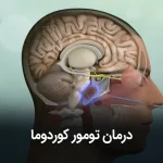 تومور کوردوما