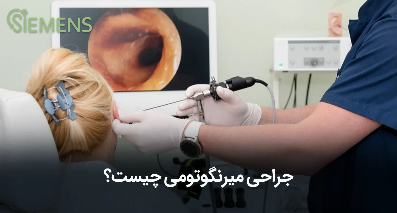 میرینگوتومی