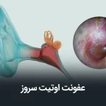 اوتیت مدیا سروزی