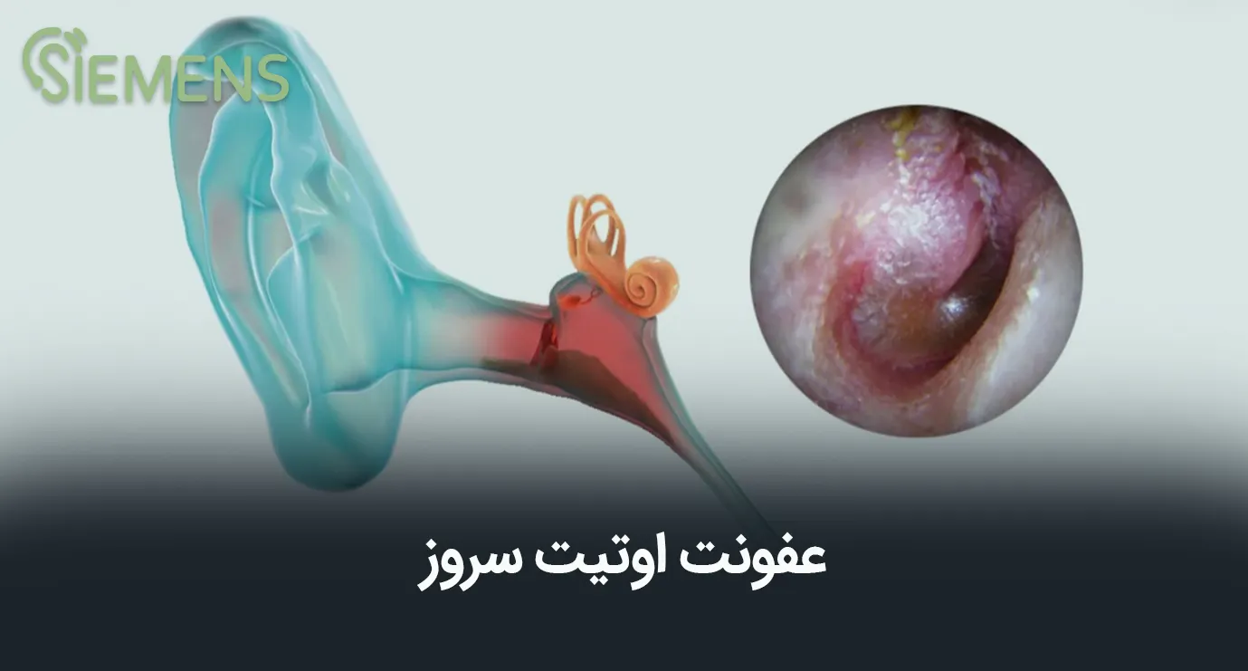 اوتیت مدیا سروزی