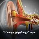 سیستم دهلیزی