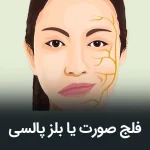 فلج بل پالسی یا فلج عصب هفت چیست