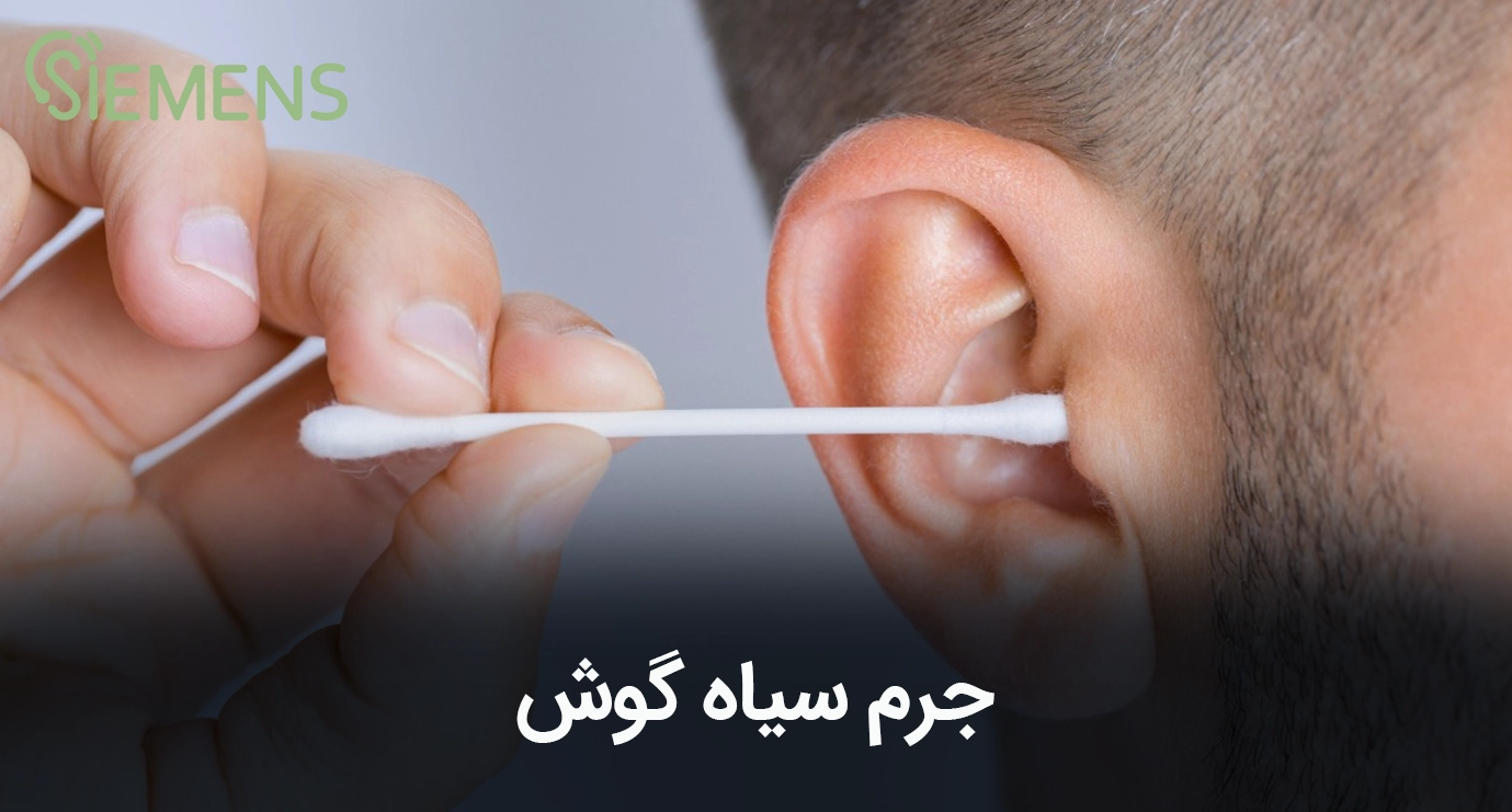 جرم سیاه گوش