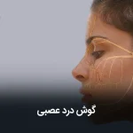 گوش درد عصبی