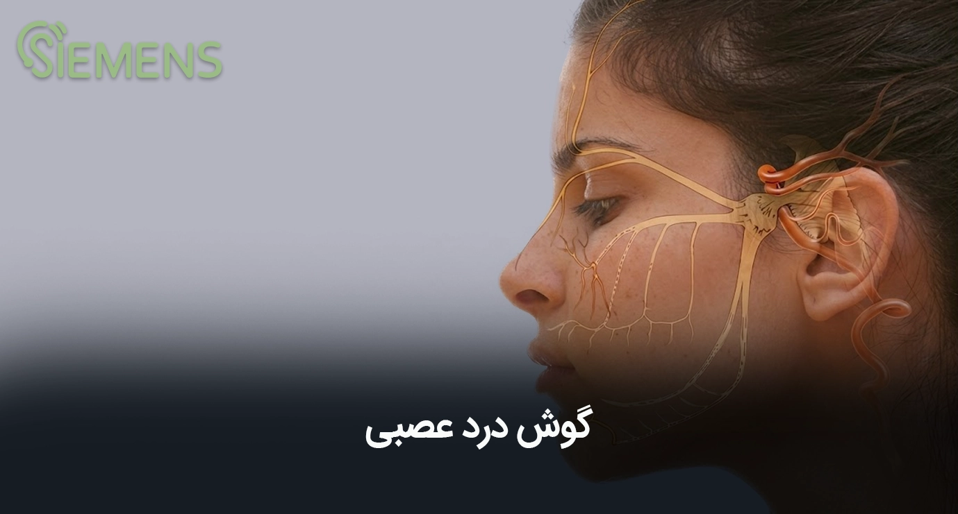 گوش درد عصبی